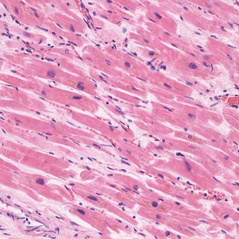 muscular-tissue