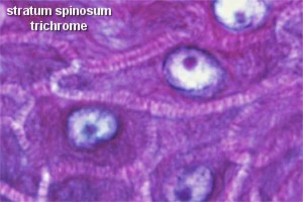 Spinosum stratum Epidermis